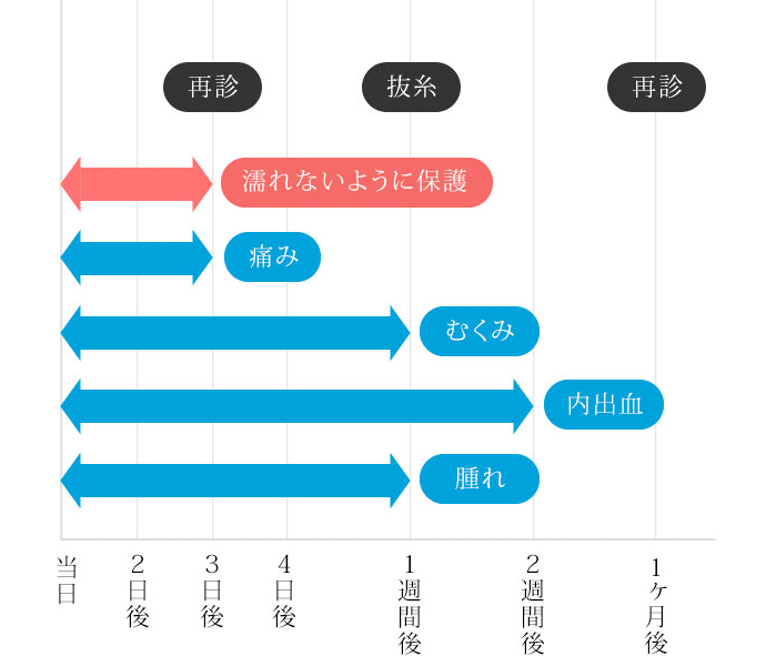 ダウンタイム