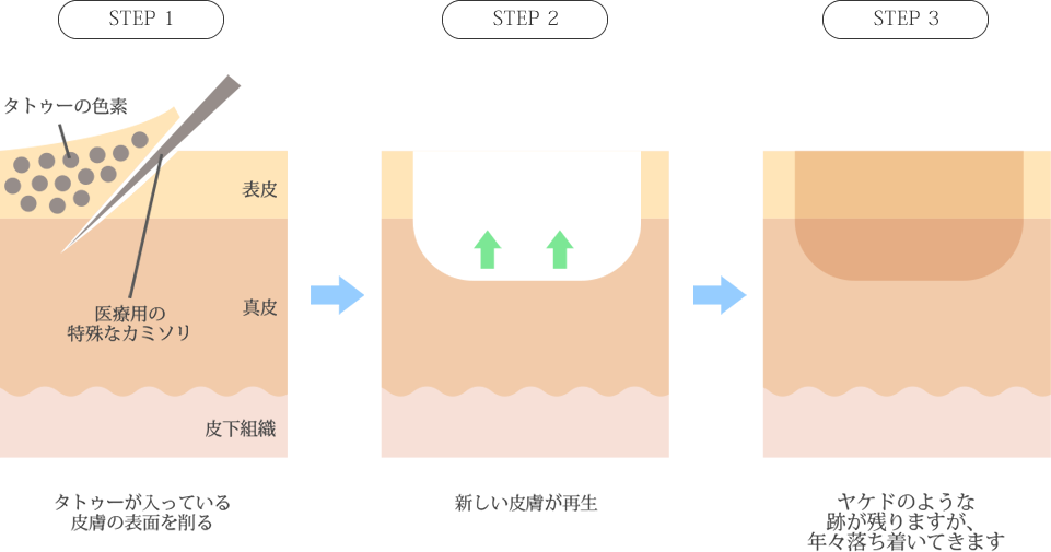 削皮術の仕組み