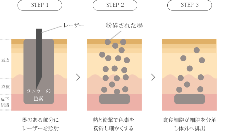 仕組み