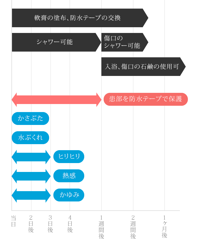 ダウンタイム