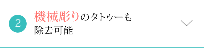 機械彫りのタトゥーも除去可能