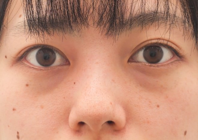 凹み
