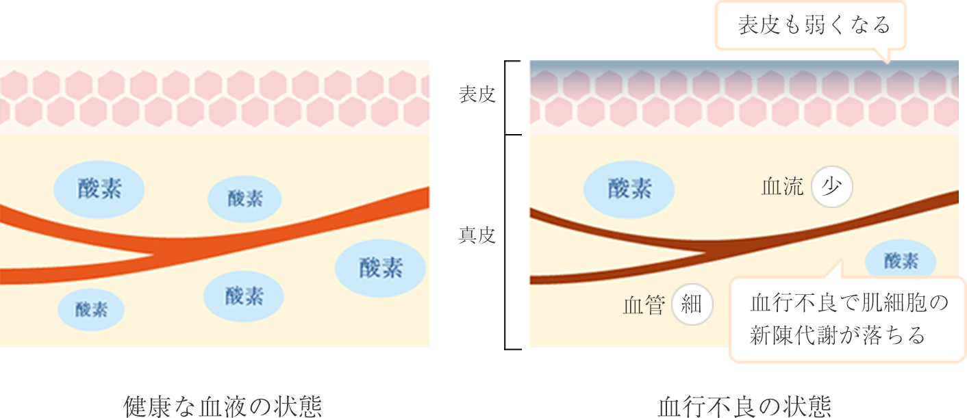 青クマの原因は血行不良