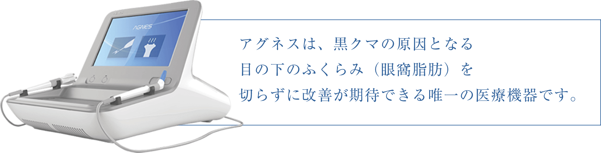 アグネスについて