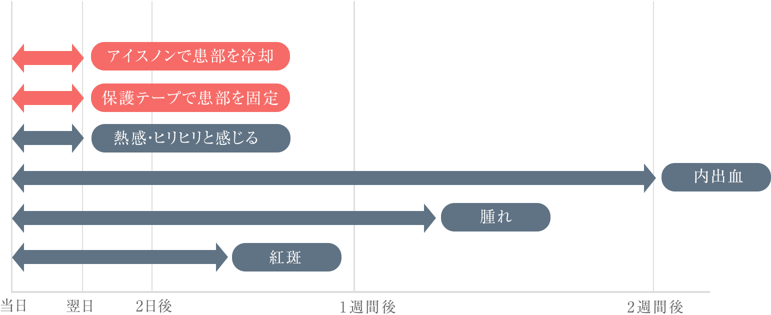 アグネス ダウンタイム
