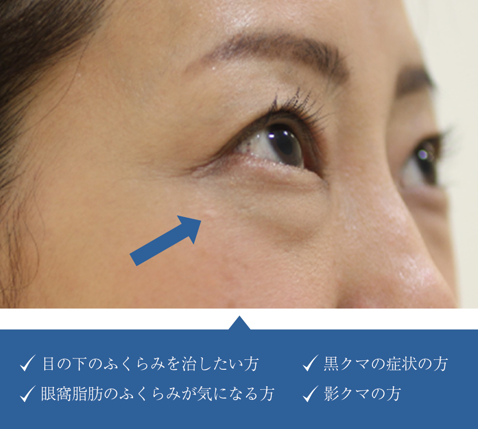「切らずにトライ」プランについて