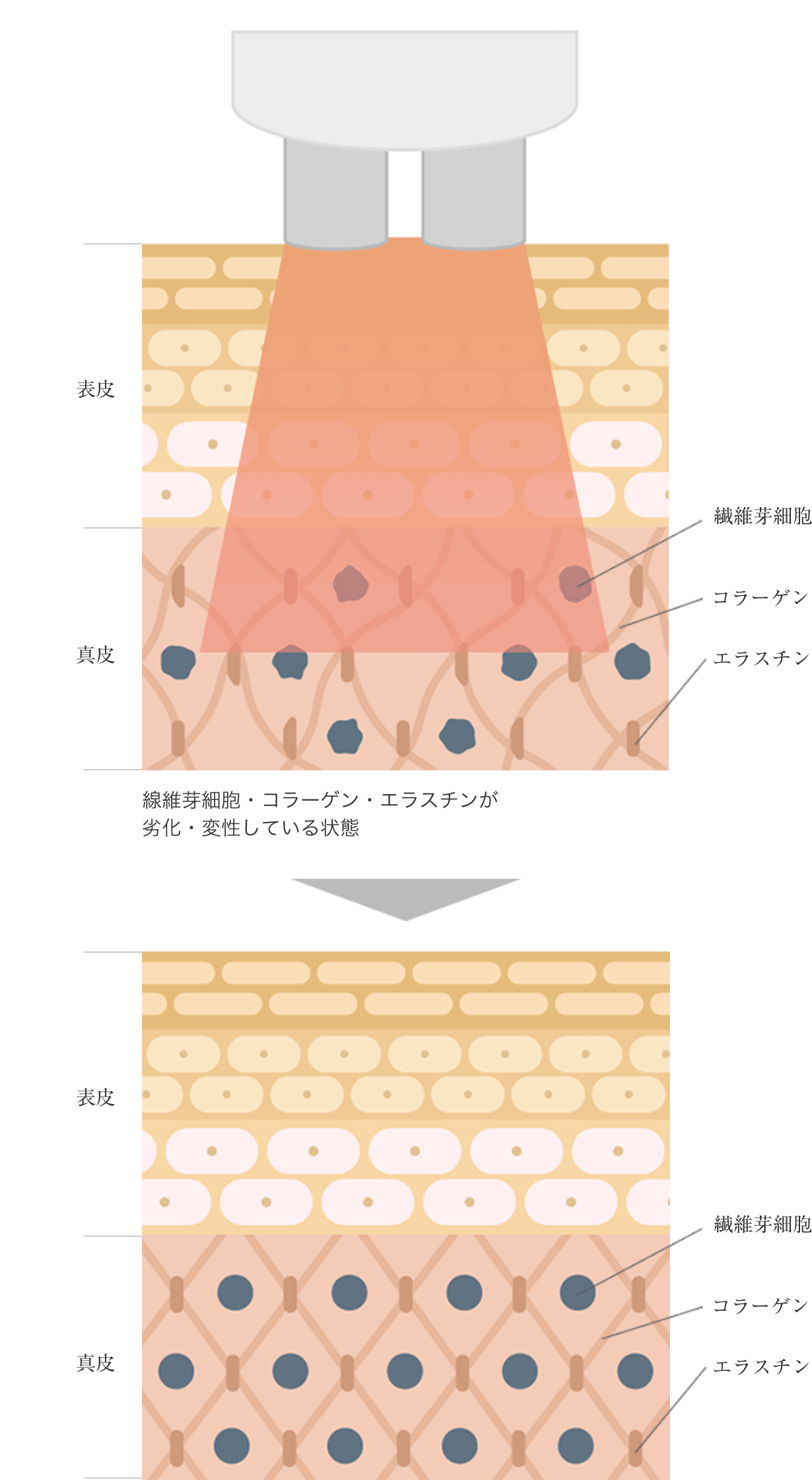 皮膚断面図とタイタンの作用