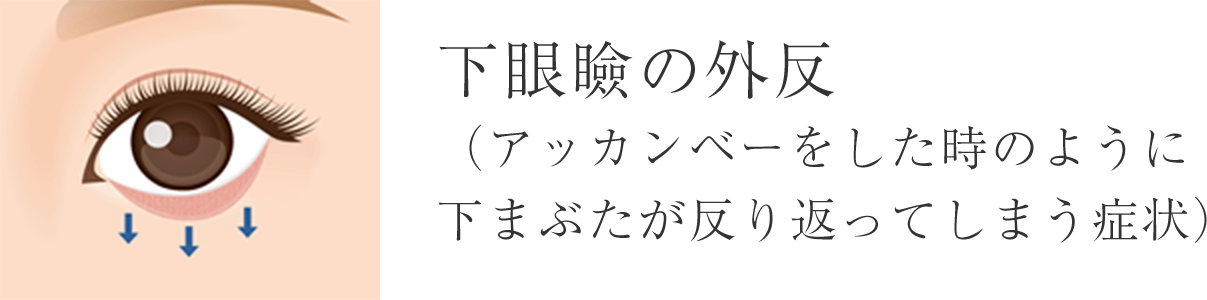 下眼瞼の外反