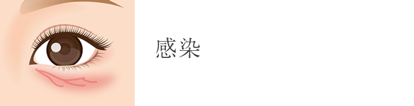 感染